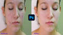 do impressive face and skin retouching frequency separation