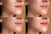 create natural beauty skin retouching in photoshop