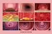 draw a medical illustration