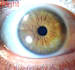do your iridology reading