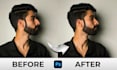 professionally reshape your nose and enhance your face naturally