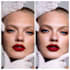 do retouching after cosmetic procedures