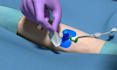 create 3d medical animation video,3d animation, 2d 3d animation video, surgery