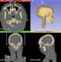 create a 3d model from your ct or mri dicoms