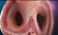 create detailed 3d medical animations, video, surgery, virus animation, anatomy