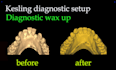 design kesling diagnostic setup