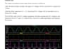 do your assigns, circuit problems, proteus working, etc