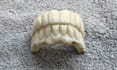 create dental artistry with exocad 3d