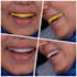 provide you excellent dental prothetic designs using exocad