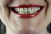 fix, adjust, whiten teeth in photoshop within 3 hours