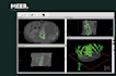 create 3d models from dicom files, ready to print