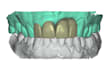 design expert dental cad cam works