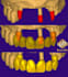 design a custom implant crown for your digital dental case
