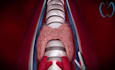 create 3d medical animation, medical video, surgery