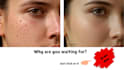 retouch your skin, remove your pimples and acne in photoshop