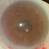 teach you ophthalmology and discuss your eye disorders