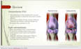create physical therapy slides professionally