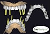 do master crafted dental design for implantwork like allonx