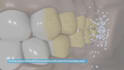create 3d medical animation, medical animation, surgery
