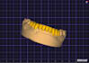 design anatomical mono, cutback and implant teeths