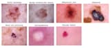 do medical image analysis using deep learning and python
