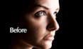 remove acne and blemishes from photos