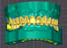 design digital dental models