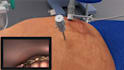 create 3d medical surgery videos