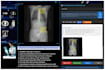 setup ohif dicom imaging viewer