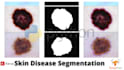 do medical imaging disease diagnosis in machine learning python