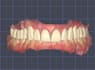 design full anatomic crowns