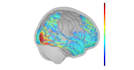do eeg data preprocessing and reporting