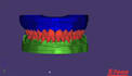 design new smiles in exocad