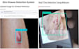 build deep learning models for medical imaging