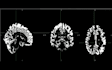 preprocess your mri images