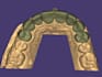 design dental crowns, bridges, implant crowns and partial dentures in exocad