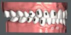 do clear aligner treatment planning as an orthodontist
