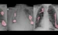 do opencv, yolo, computer vision, image processing, nlp in python