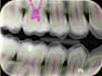 deliver a highly precised annotated dental radiograph