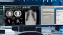 deploy dicom pacs orthanc clearcanvas dcm4chee