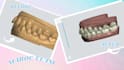 your design clear aligner orthodontic case with 3shape ortho