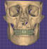 design dental cad cam restorations using exocad and 3shape