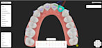 provide dental clear aligners treatment planning services