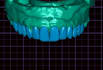 make your cad dental design with high quality