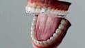 create 3d dental implant animation orthodontic explainer and dental device video