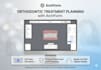 custom aligner treatment plans with 3d clincheck
