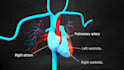 create 3d animation video for medical projects