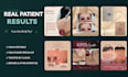 design medical and healthcare social media posts for clinics and medspas