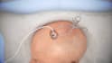 create realistic 3d medical animations 3d neurosurgery brain anatomy animation