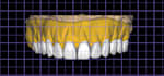 make dentures on exocad